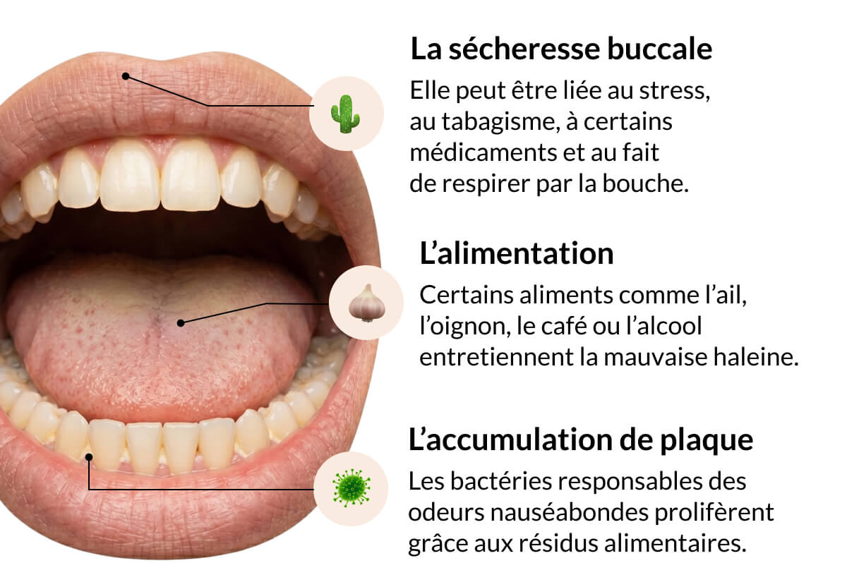 La sécheresse buccale Elle peut être liée au stress,  au tabagisme, à certains médicaments et au fait  de respirer par la bouche. L’alimentation Certains aliments comme l’ail, l’oignon, le café ou l’alcool entretiennent la mauvaise haleine. L’accumulation de plaque Les bactéries responsables des odeurs nauséabondes prolifèrent grâce aux résidus alimentaires.