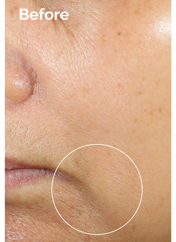 Before using Caffeine 3% + Escin 1% Face Serum