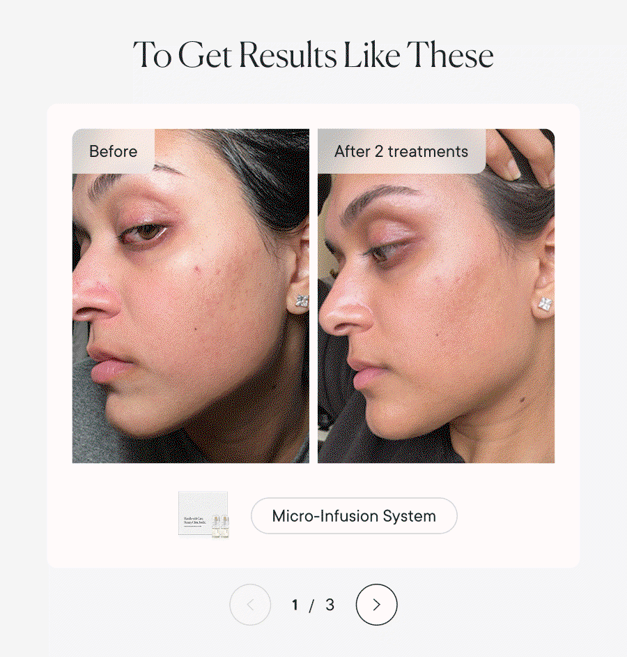 To Get Results Like These