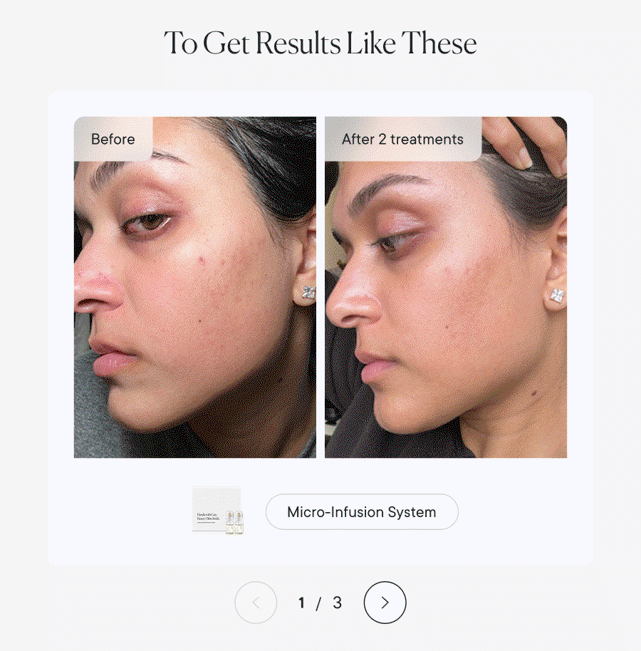 To Get Results Like These