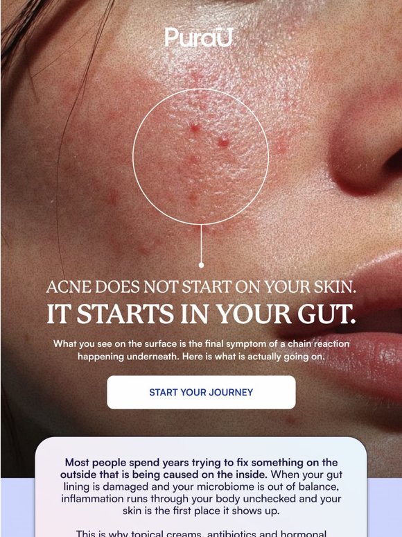 Your skin isn't the problem. Your gut is.