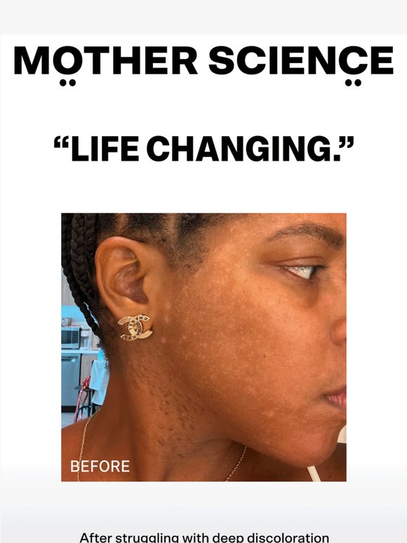 “Life Changing” Results, In Her Own Words