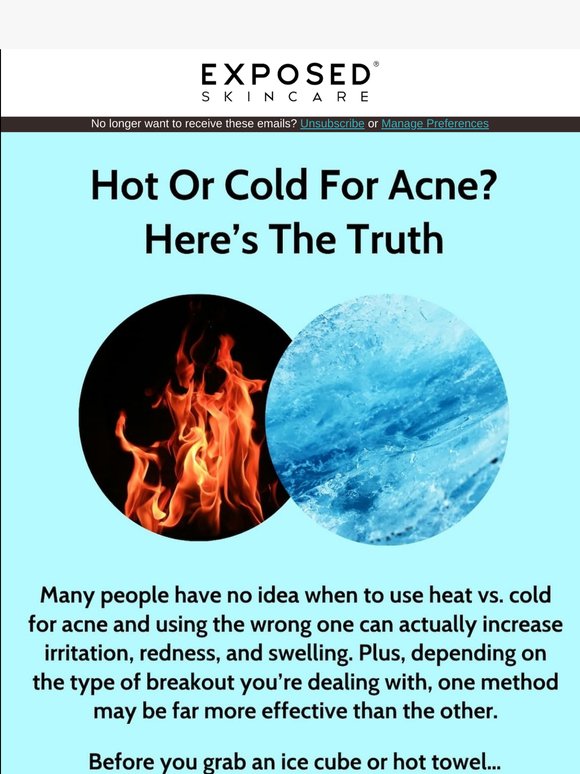 🔥 🧊 Hot or Cold for Acne? Here’s the Truth.