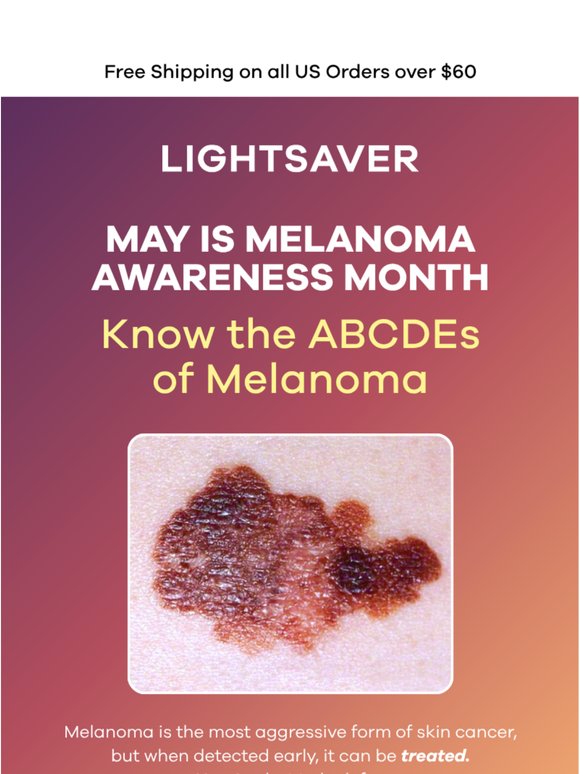 ABCDEs of Melanoma