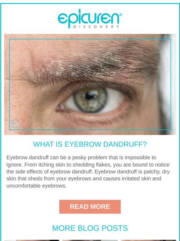 What Is Eyebrow Dandruff? 🤨
