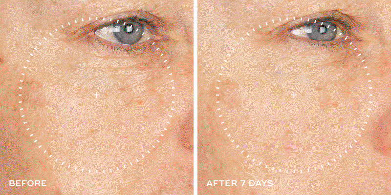 Before & After