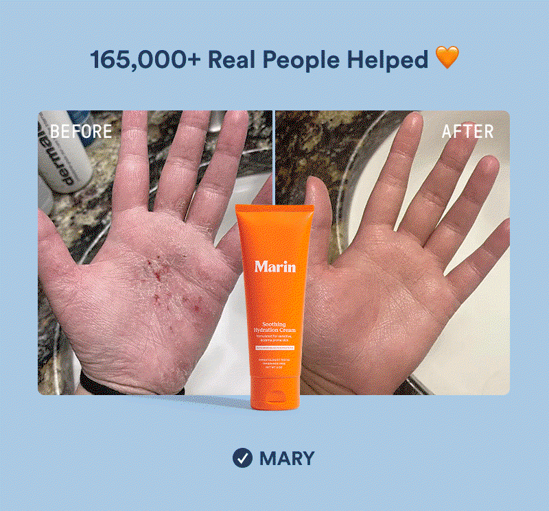 Before-and-after photo of a person’s hand showing severe dryness, cracking, and irritation on the left side labeled “Before,” and visibly smoother, healed skin on the right side labeled “After.” An orange tube of Marin Soothing Hydration Cream is centered between the two images. Text at the top reads “165,000+ Real People Helped 🧡,” with a verified customer name, “Mary,” displayed below.