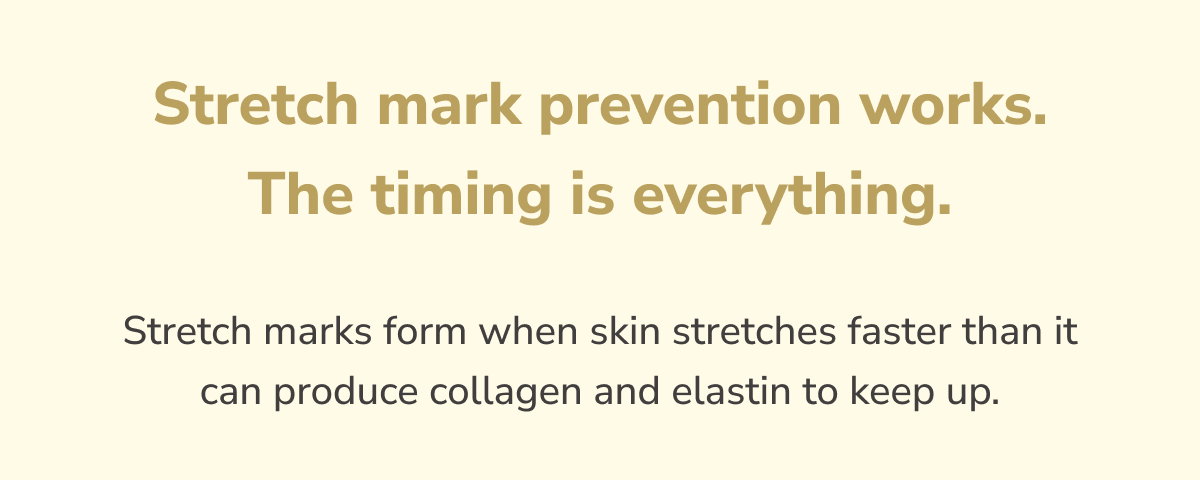Stretch mark prevention works. The timing is everything.  Stretch marks form when skin stretches faster than it can produce collagen and elastin to keep up.