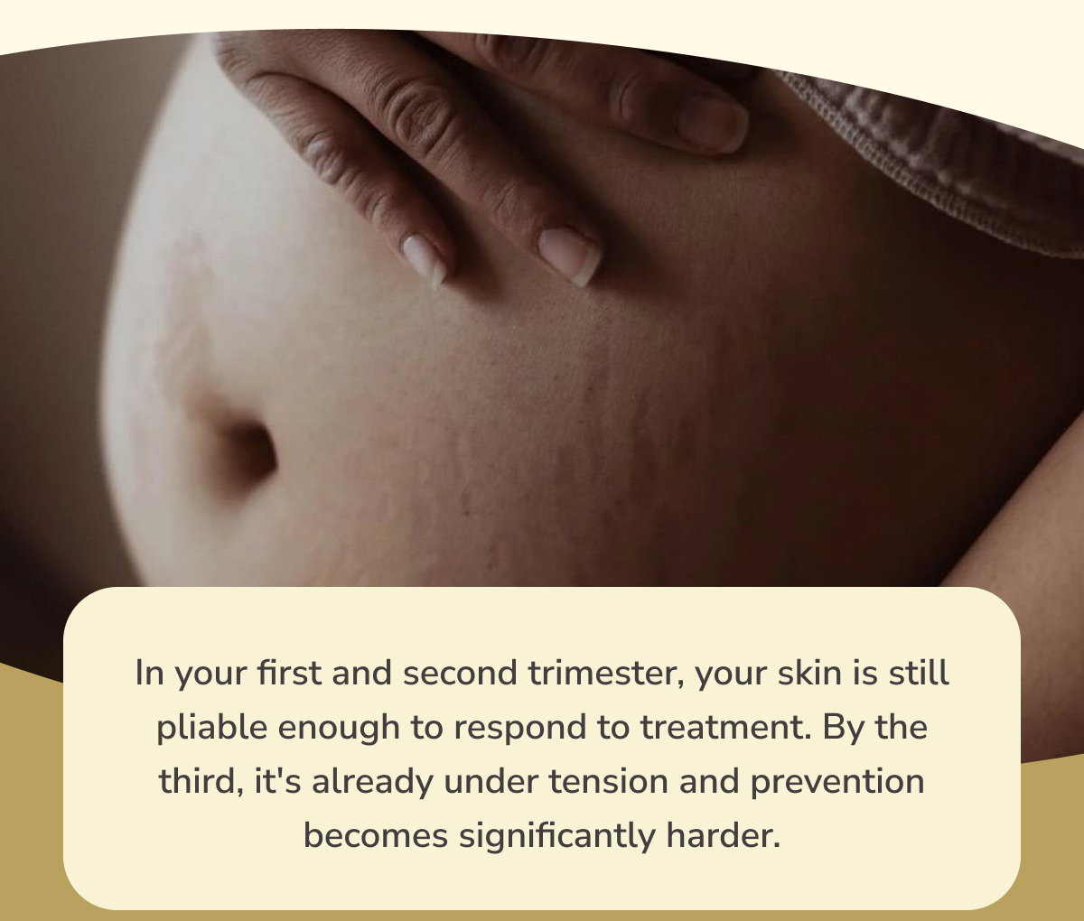 In your first and second trimester, your skin is still pliable enough to respond to treatment. By the third, it's already under tension and prevention becomes significantly harder.