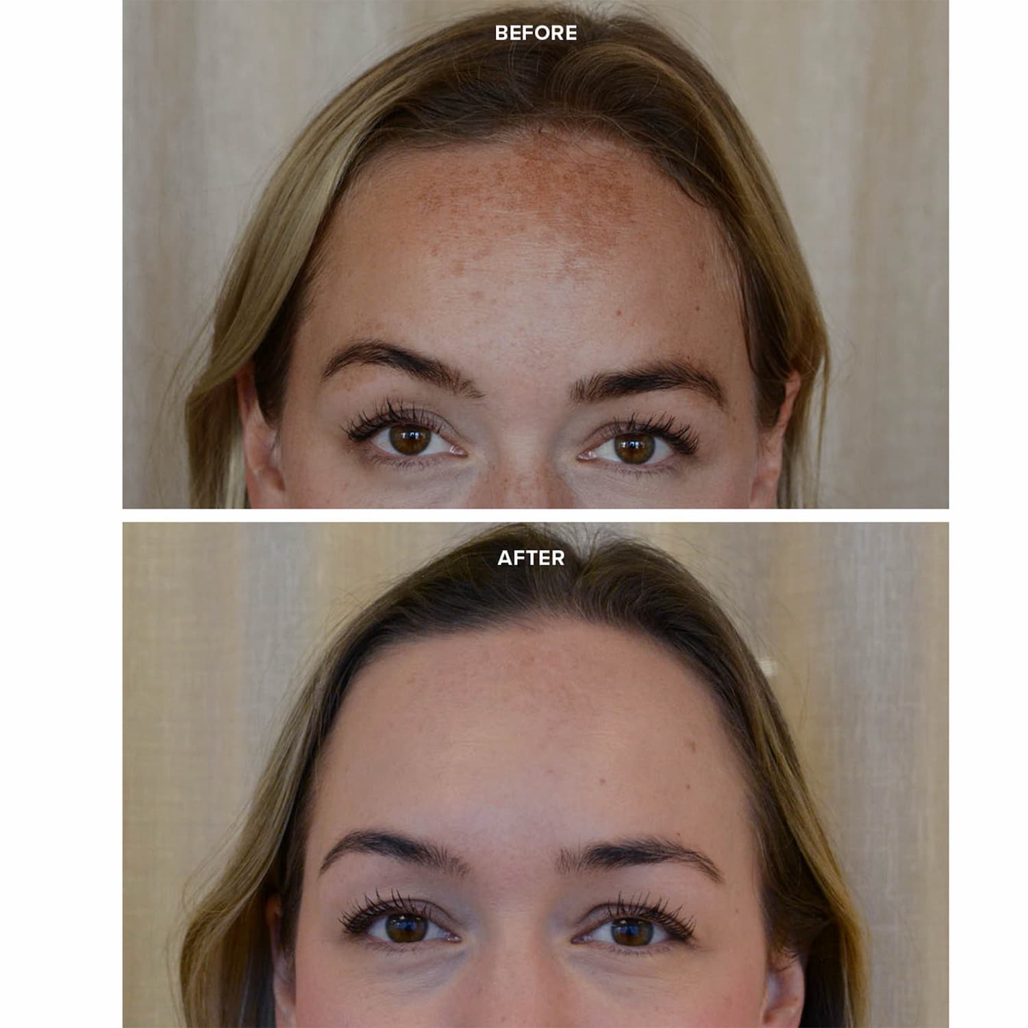 PRIORI LED Mask Before and After