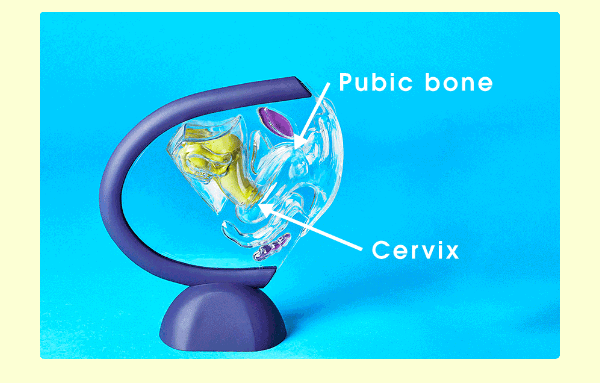 How to use Nixit Menstrual Disc