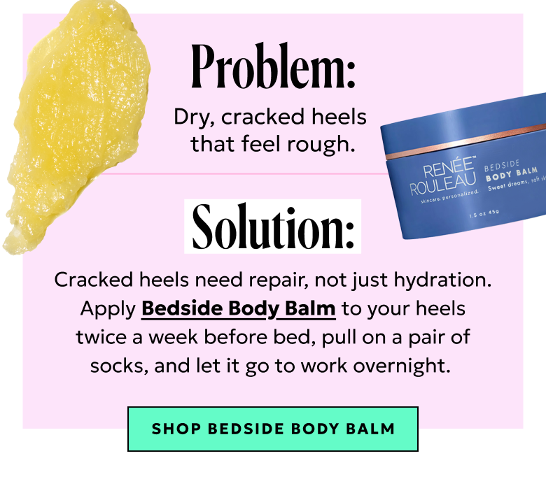 Problem: Dry, cracked heels that feel rough. Solution: Apply Bedside Body Balm to your heels twice a week before bed and pull on a pair of socks.