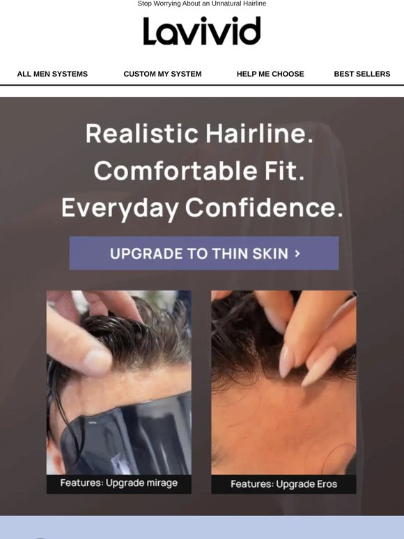 Fake Hairline? Meet the Thin Skin Solution