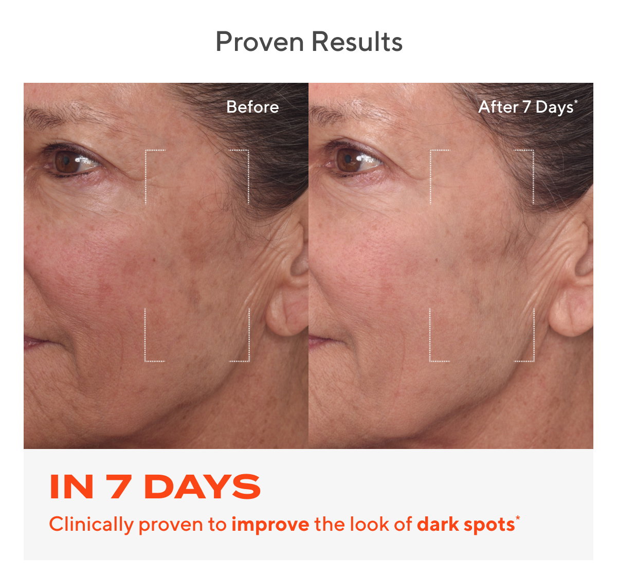 Improve The Look Of Dark Spots In Just 7 Days