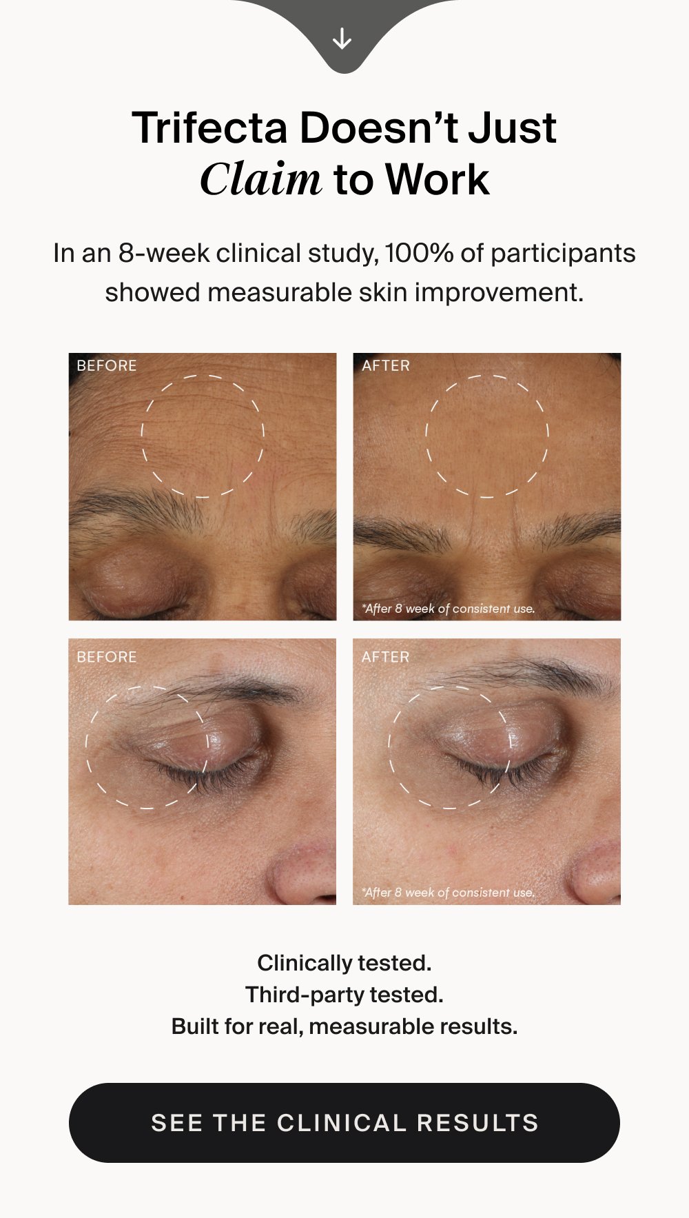 Trifecta Doesn’t Just Claim to Work In an 8-week clinical study, 100% of participants showed measurable skin improvement. Clinically tested. Third-party tested. Built for real, measurable results. SEE THE CLINICAL RESULTS