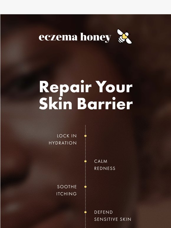Spring might be your skin’s worst season