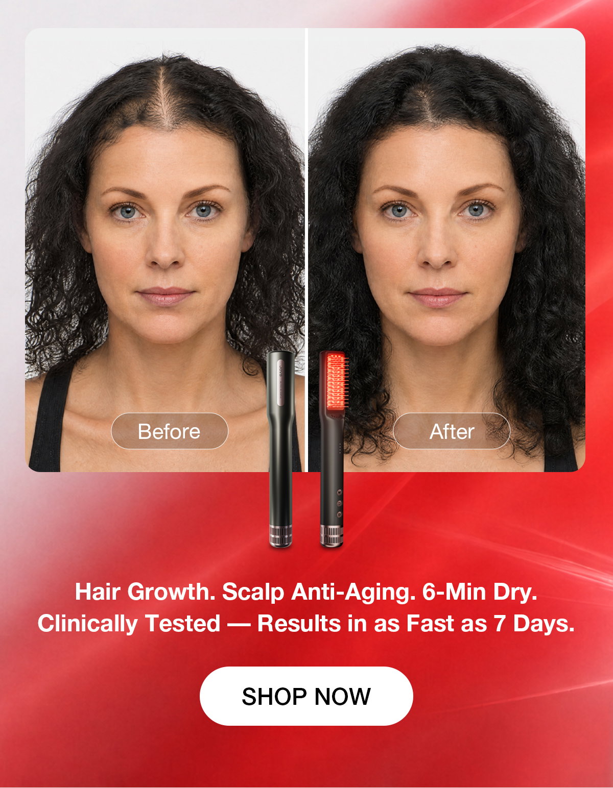 Hair Growth. Scalp Anti-Aging. 6-Min Dry. Clinically Tested — Results in as Fast as 7 Days.