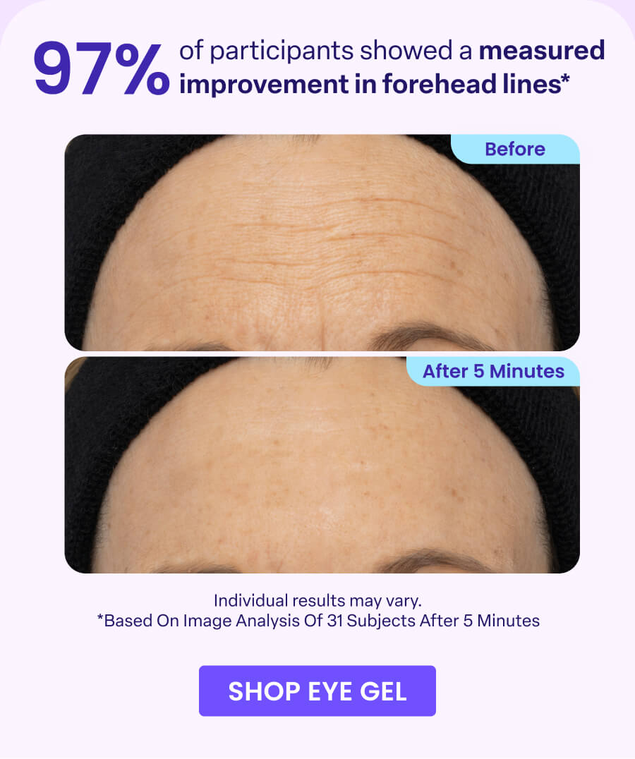 97% of participants showed a measured improvement in forehead lines* Before After 5 Minutes Individual results may vary. "Based On Image Analysis Of 31 Subjects After 5 Minutes SHOP EYE GEL
