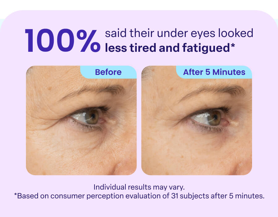 100% said their under eyes looked less tired and fatigued* Before After 5 Minutes Individual results may vary. *Based on consumer perception evaluation of 31 subjects after 5 minutes.