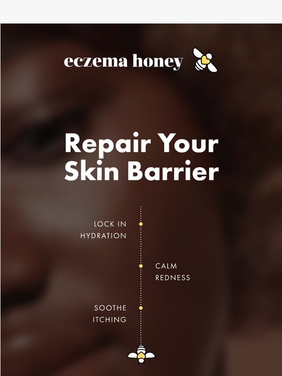 Spring might be your skin’s worst season