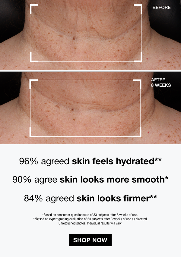 or skin that is more youthful-looking with a healthy, non-greasy glow.﻿​