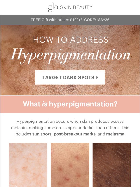 How to Target Hyperpigmentation