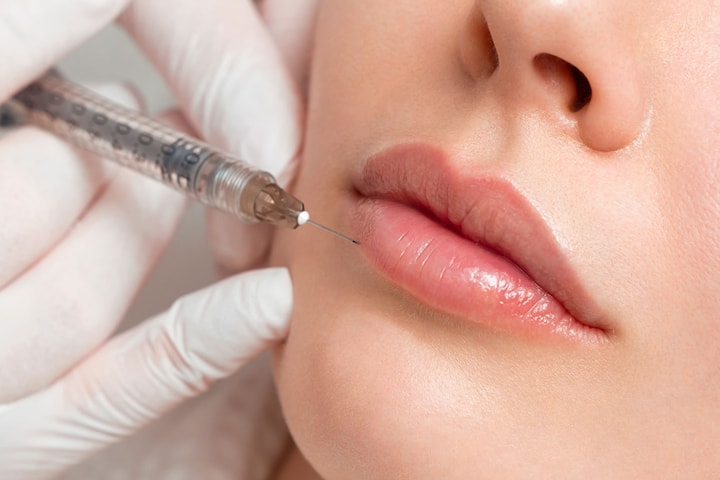 Fillers 1-2 ml valfritt område på Östermalm
