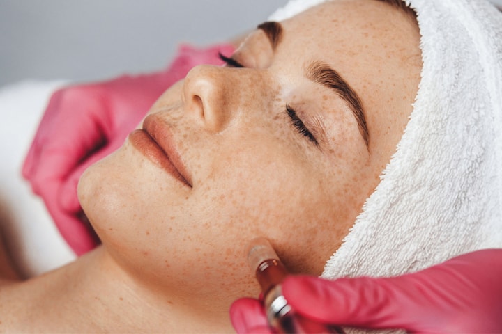 Microneedling med Dermapen och serum för hudföryngring på Södermalm