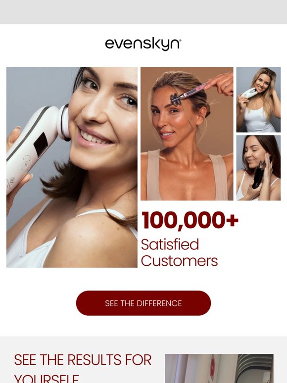 100,000+ women transformed their skin with EvenSkyn