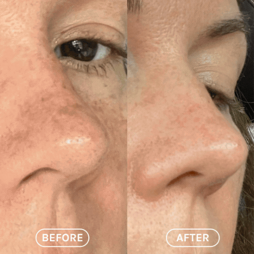 resveratrol + niacinamide serum