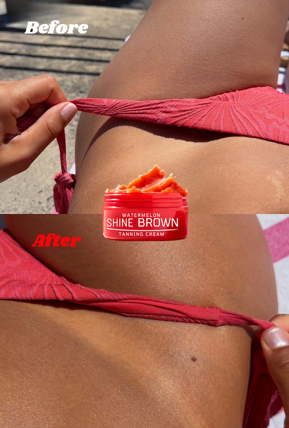 Before - After