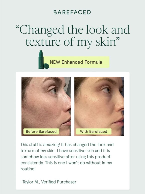 One Serum, Real Skin, These Results 🤍
