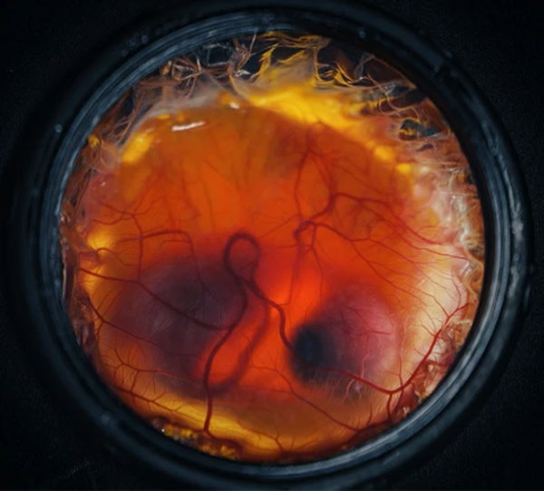 A top down view of a developing chicken embryo in the circular hatching device by Colossal.