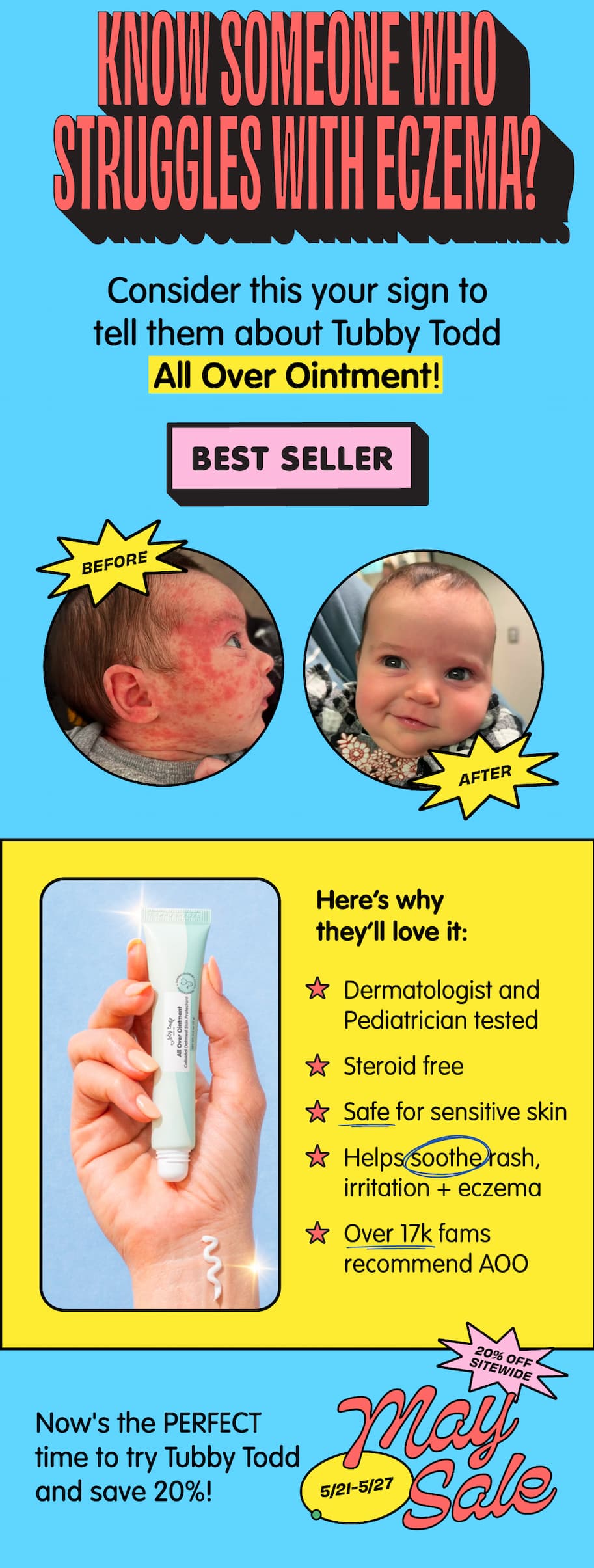 Before-and-after eczema results featuring Tubby Todd All Over Ointment, highlighting soothing relief for sensitive skin and a limited-time 20% off May sale starting 5/21