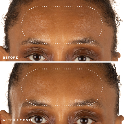 Skin Health Improvement