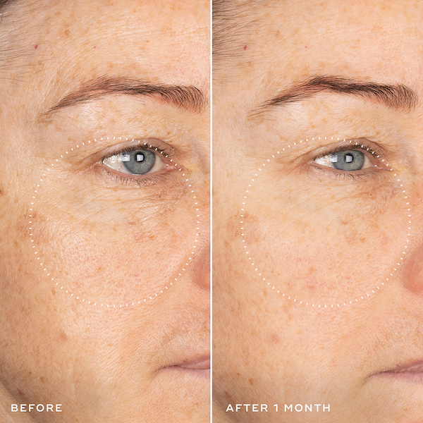 Skin Tone Improvement