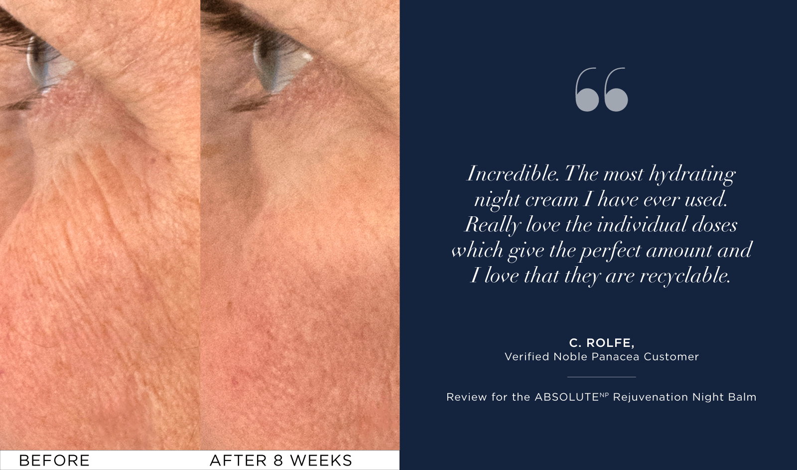 Rejuvenation Night Balm Results