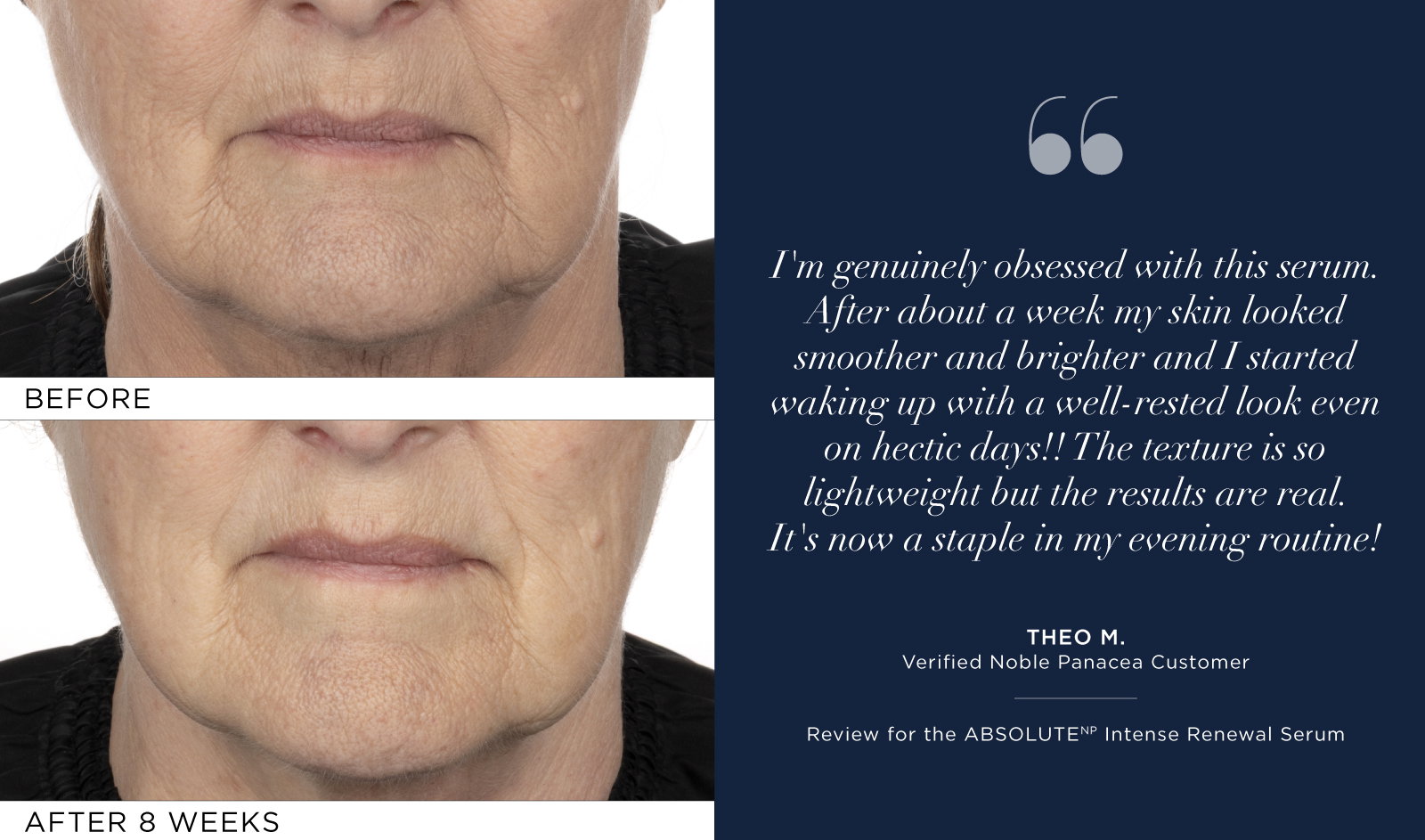 Peptide8 Night Serum Results