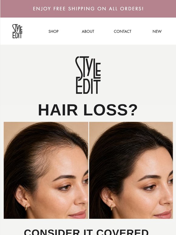 Fix Thinning Hair, Fast with 30% Off