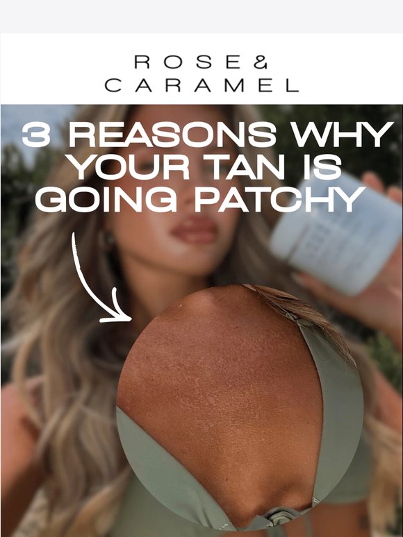 Patchy Tan Explained!✨