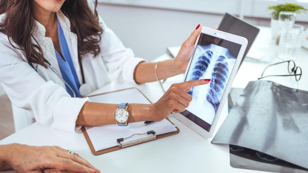 Cancer du poumon: un nouveau programme de dépistage lancé, voici comment y participer