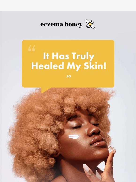 ”It has truly healed my skin!”-Jo