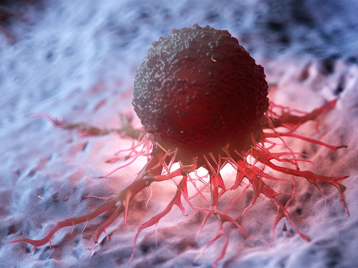 Illustration of cancer tumor