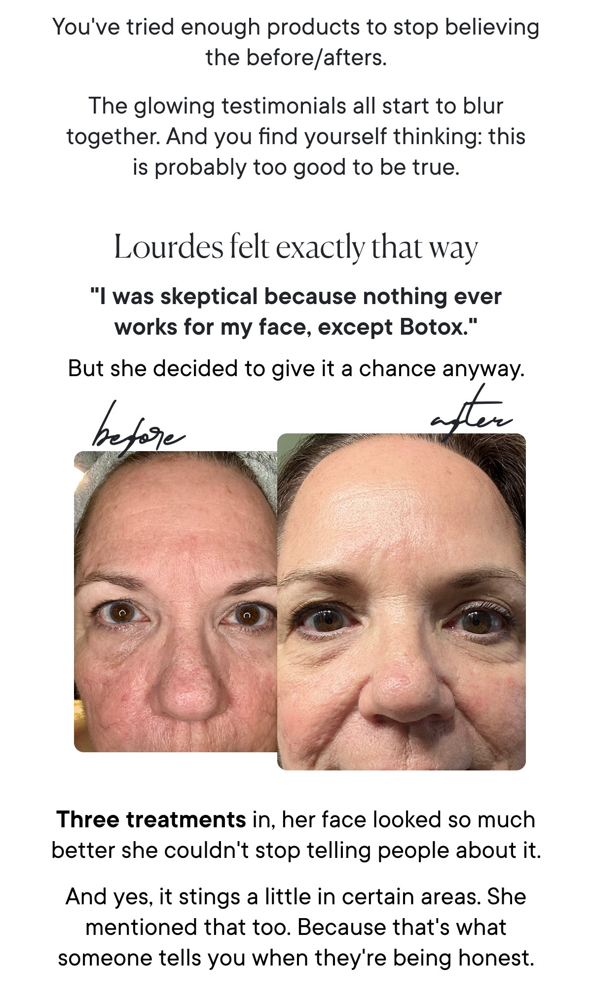 "I was skeptical because nothing ever works for my face, except Botox."