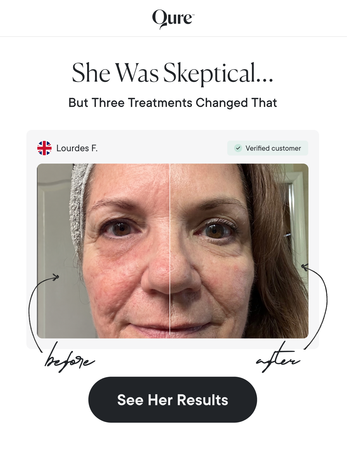 She Was Skeptical… But Three Treatments Changed That