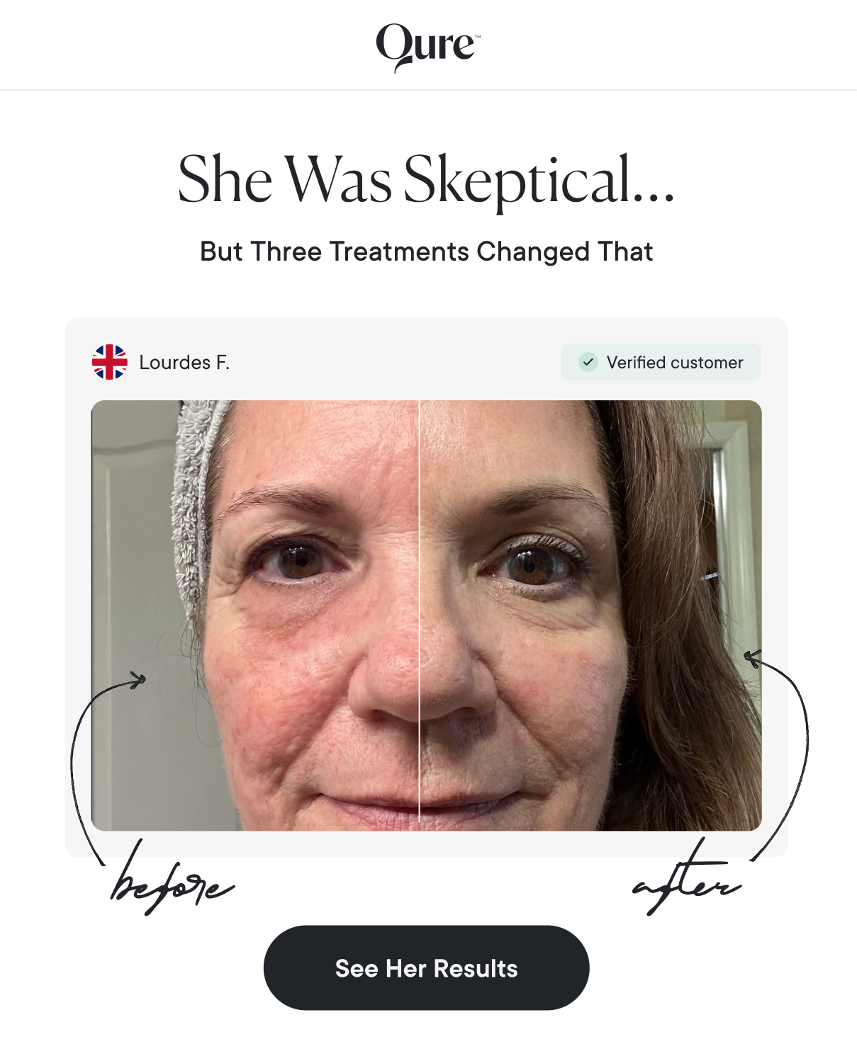 She Was Skeptical… But Three Treatments Changed That