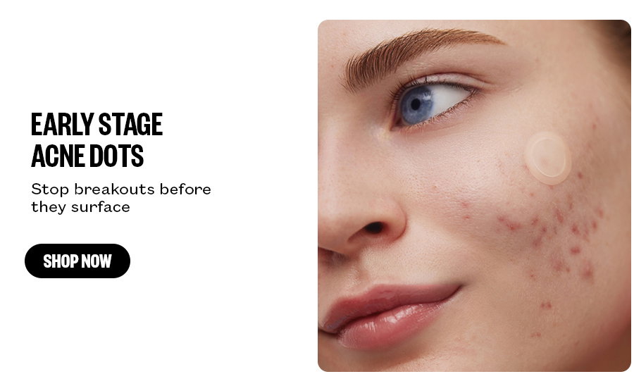 Early Stage Acne Dots - Stop breakouts before they surface