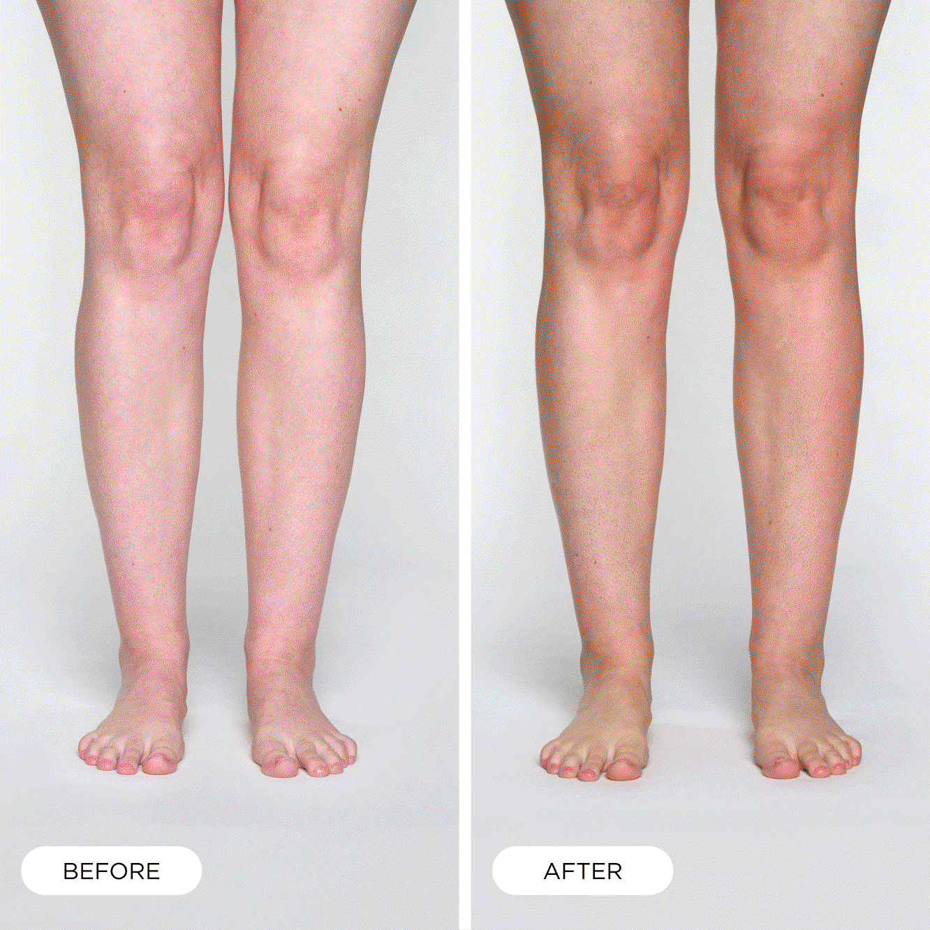 Summer Skin Gradual Tanning Serum