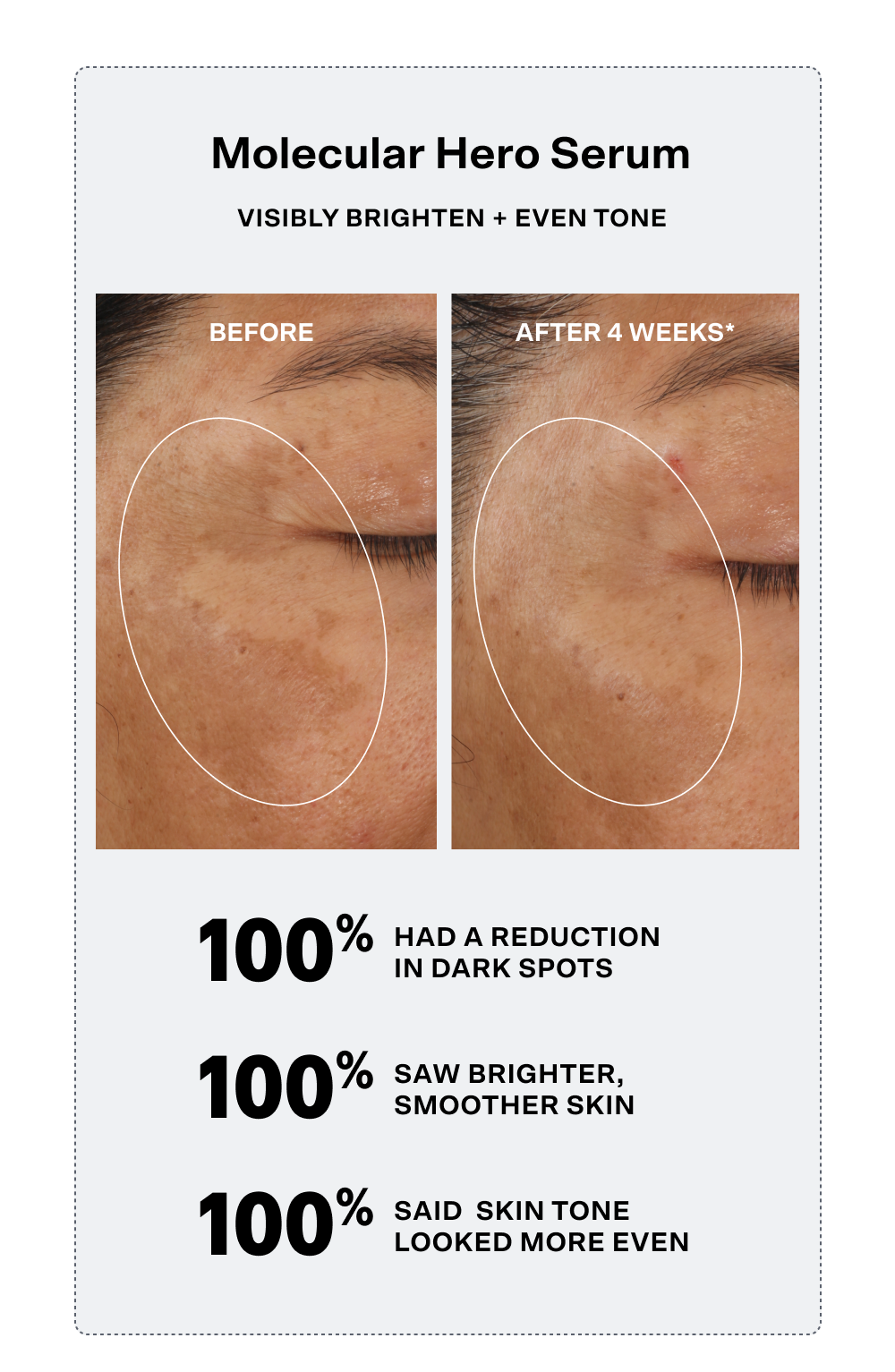 Molecular Hero Serum