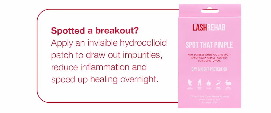 Spotted a breakout?
